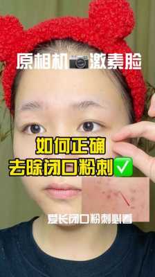 粉刺该如何去除,怎么消除粉刺最快最有效
