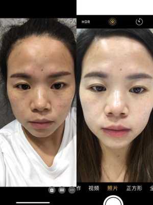 怎么样美白淡斑（去斑美白方法）