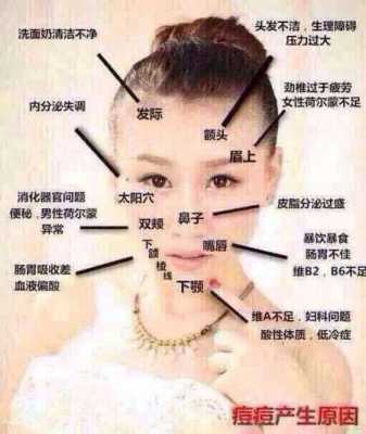 下巴长痘痘是为什么，有哪些原因,下巴痘痘是什么原因导致的