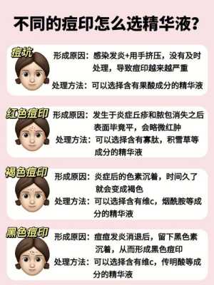 长痘痘怎么处理（长痘痘怎么处理不会留痘印）