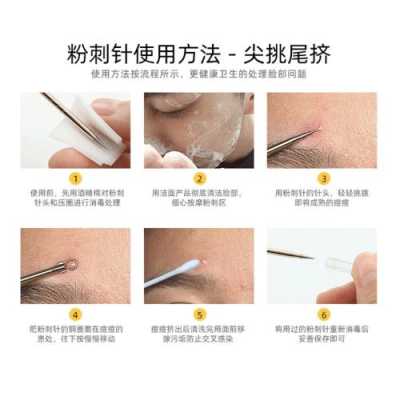 去黑头什么好用（去黑头是用粉刺针还是棉签）