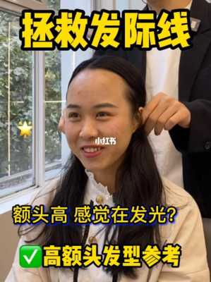 额头高怎么办（额头太高怎么办）