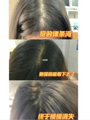 为什么身体上其它部位的毛长到一定程度就不再长，而头发却能不断长长,长头发适合什么发型男