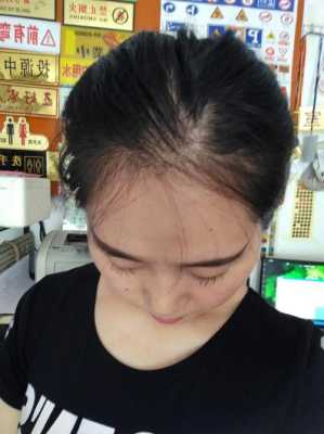 为什么发尾头发特别少,为啥头发稀少