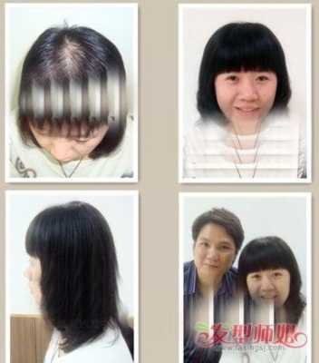 头发怎么长得慢（为什么头顶头发长得最慢）
