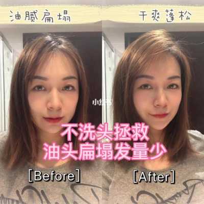 头发怎么增多（让头发增多的方法）