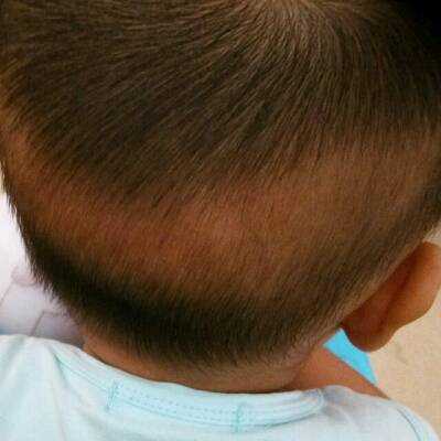 小学生适合什么发型（孩子后脑勺有一块没有头发是什么情况）