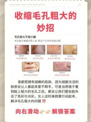 怎么收毛孔（怎么收毛孔有效果）