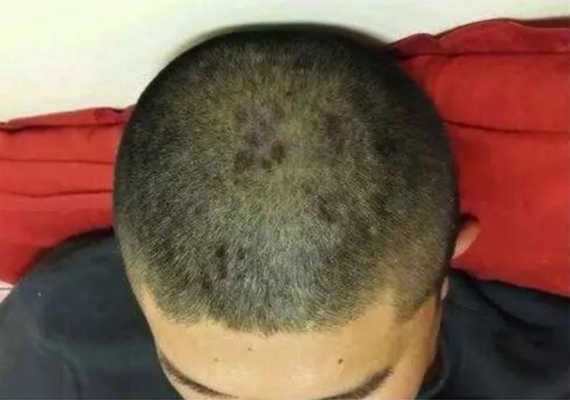 为什么头发很脆很硬,为什么头发很硬,摸一根的时候很凹凸不平