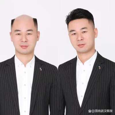 男士假发怎么戴（男士假发怎么带）