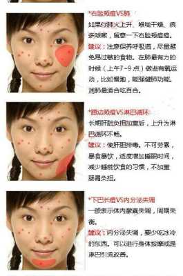 下巴长痘痘是什么原因，会有什么影响,冬季下巴起痘怎么回事
