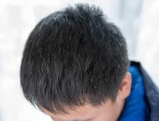 为什么白头发很多（为什么白头发很多）