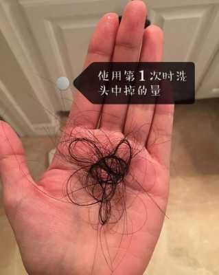 头发掉发怎么办（头发掉发怎么办）