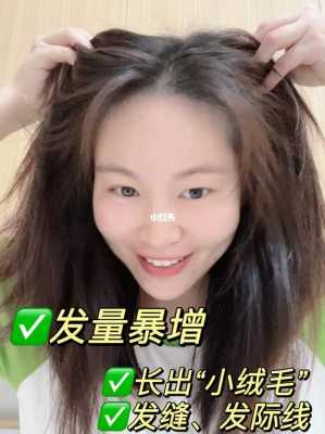 增加头发多的方法,怎么增加头发的发量