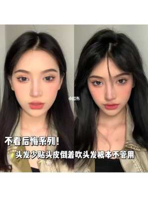 头顶头发塌怎么办（头顶头发塌怎么办图片）