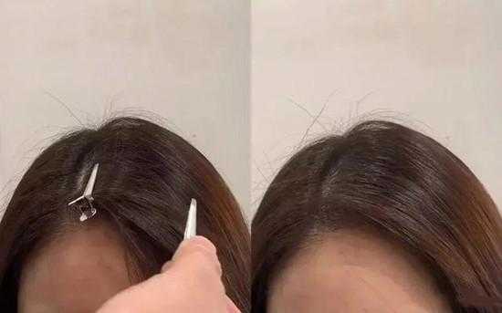 头发碎怎么办（头发有碎毛咋办）