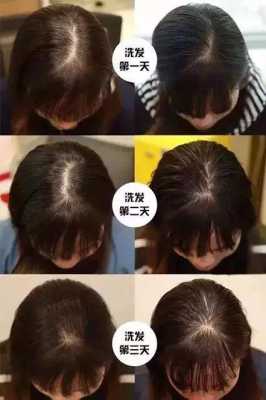 头发又油又少怎么办（头发又油又少怎么办,剃了会不会变好）