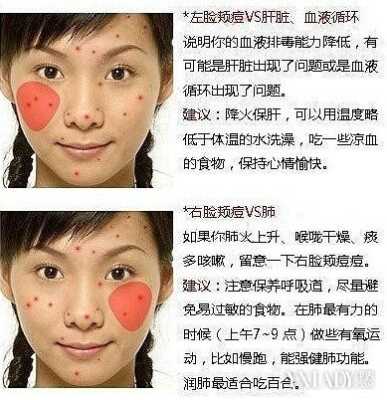 脸上长痘痘怎么消（脸上长痘痘怎么消）