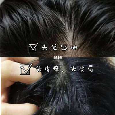 头发出油怎么洗（头皮总出油怎么办）