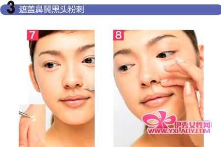 鼻翼痘痘怎么消除小妙招,鼻翼长痘痘怎么办