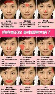 脸上长青春痘怎么（脸上长青春痘怎么）