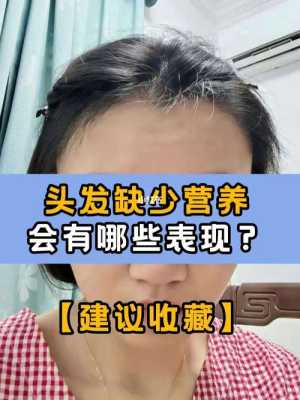 头发缺营养怎么办（头发缺营养怎么办）