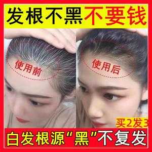用什么方法白发变黑发,白头发怎么变黑头发?
