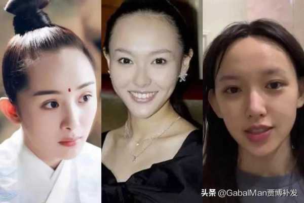 发际线为什么会变高（为啥明明头发很多为什么发际线还那么高）