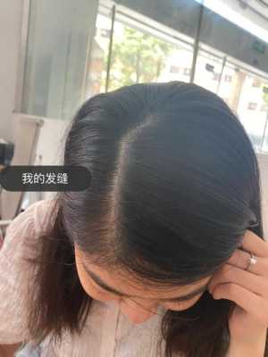 头发掉的很多怎么办（掉头发厉害长出来很多短发怎么办）