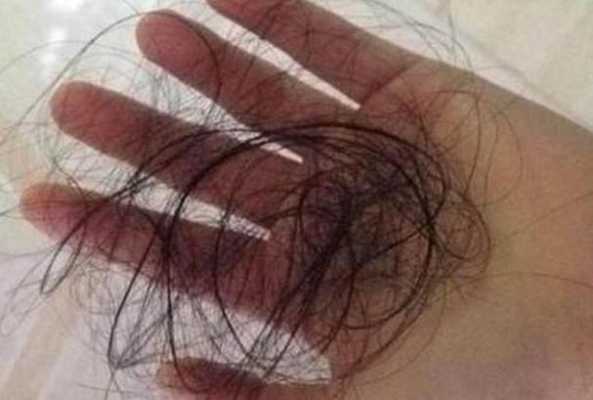 洗发露附着在头发上洗不掉是什么原因,怎么洗头发不掉发而且生发