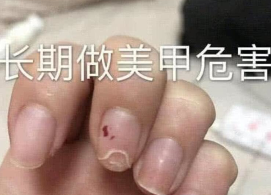 美甲为什么容易脱落（自己做的美甲为什么容易脱落）