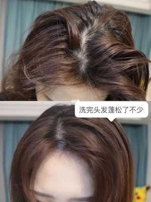 头发很痒是怎么回事（用了拉芳洗发水头很痒,是怎么回事）