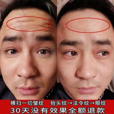怎么防皱（怎么防皱纹最好）