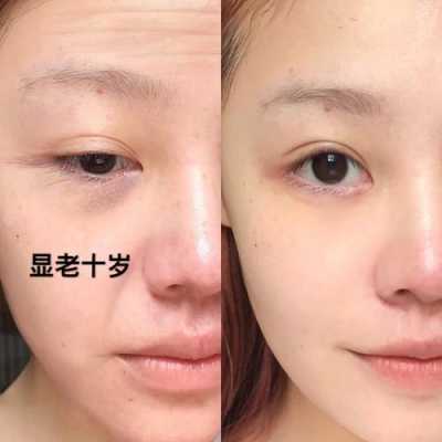 怎么防皱（怎么防皱纹最好）