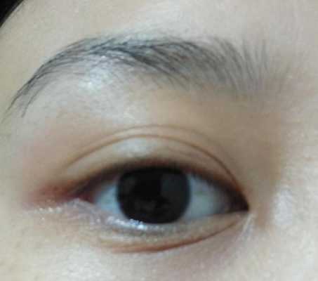 有眼纹怎么办,有眼角纹怎么办?
