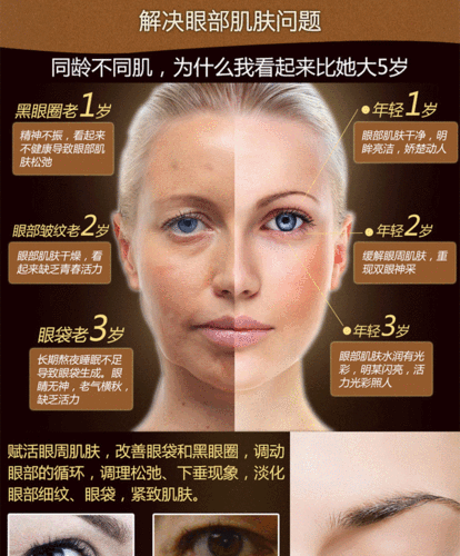 最有效祛除眼袋和黑眼圈的方法有哪些,黑眼圈和眼袋怎么消除?
