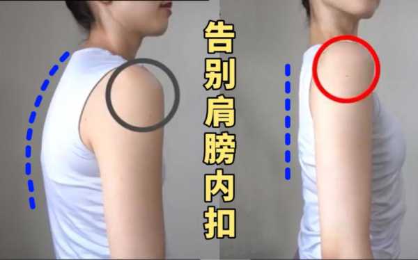肩膀内扣怎么纠正（肩膀内扣可以恢复吗）