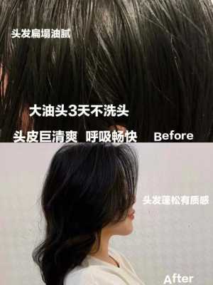 头发油不能洗头怎么办（不洗头油头能恢复吗）