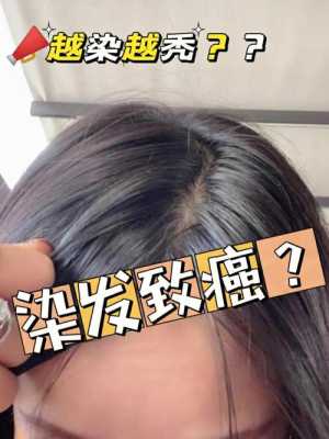 染发掉头发怎么办（染发掉头发怎么办?怎么治?）