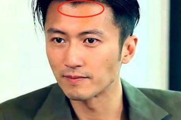 美人尖怎么（怎么把美人尖去掉）