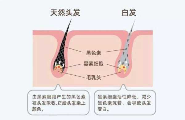 如何黑发,怎么让头发黑色素增多