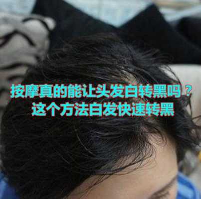 如何黑发,怎么让头发黑色素增多