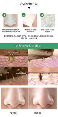 怎么去黑头和粉刺,怎么去除粉刺和黑头的方法