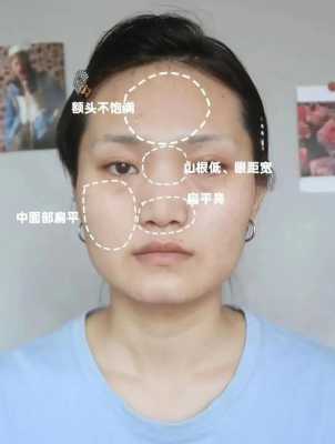 脸很扁平怎么办,扁脸是怎么造成的