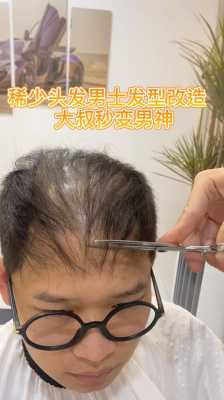 男性头发稀少怎么办（男性头发稀少怎么补救）
