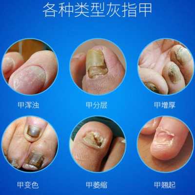 甲液是什么（甲液是什么意思）