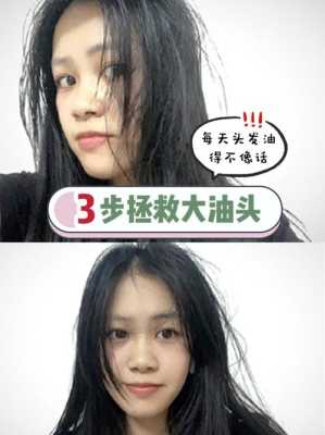 头发太容易油，2天就脏了，有没有什么方法,头发太油怎么改善女生