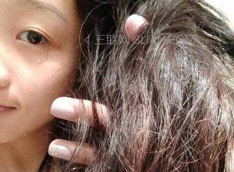 头发干枯分叉怎么办小窍门,头发干枯开叉怎么办 怎样护理才有效