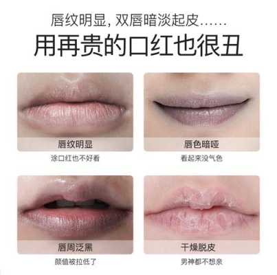 唇纹明显怎么办（怎么淡化唇纹）