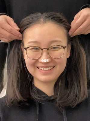 前额头发少怎么办（前额头发少怎么办女生）